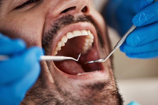 Best Oral Cancer Screening  in North Enid, OK